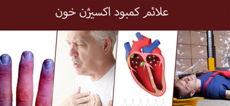 آشنایی با علائم کاهش اکسیژن سطح خون در بیماران کرونایی