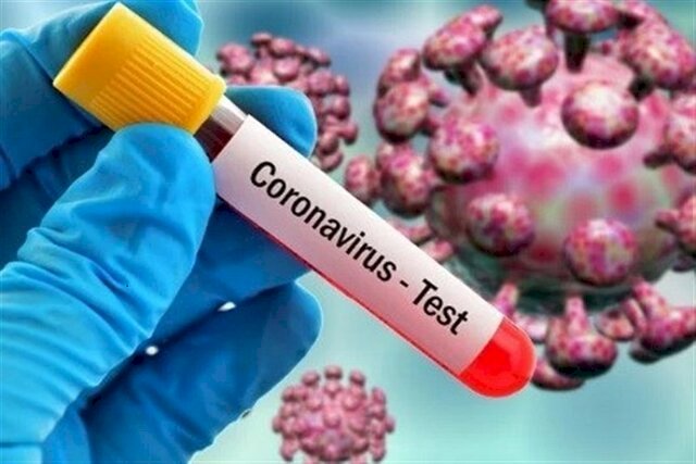بررسی تفاوت تست های مختلف ویروس کرونا